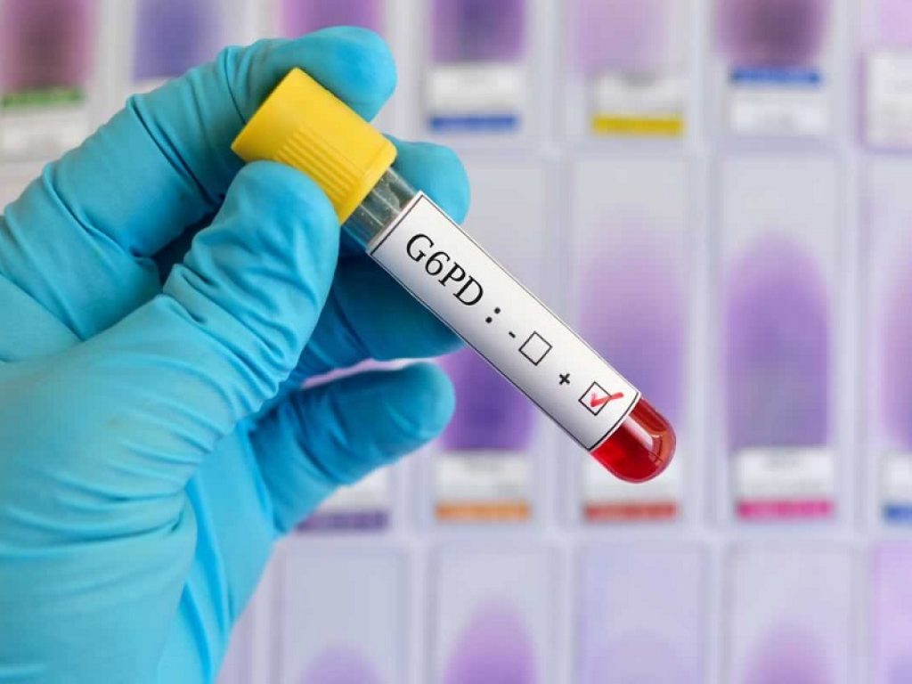 Favismo: rischio di crisi emolitiche con due farmaci anti-Coronavirus. L'Istituto Superiore di Sanità avverte: evitare l'uso di clorochina e idrossiclorochina