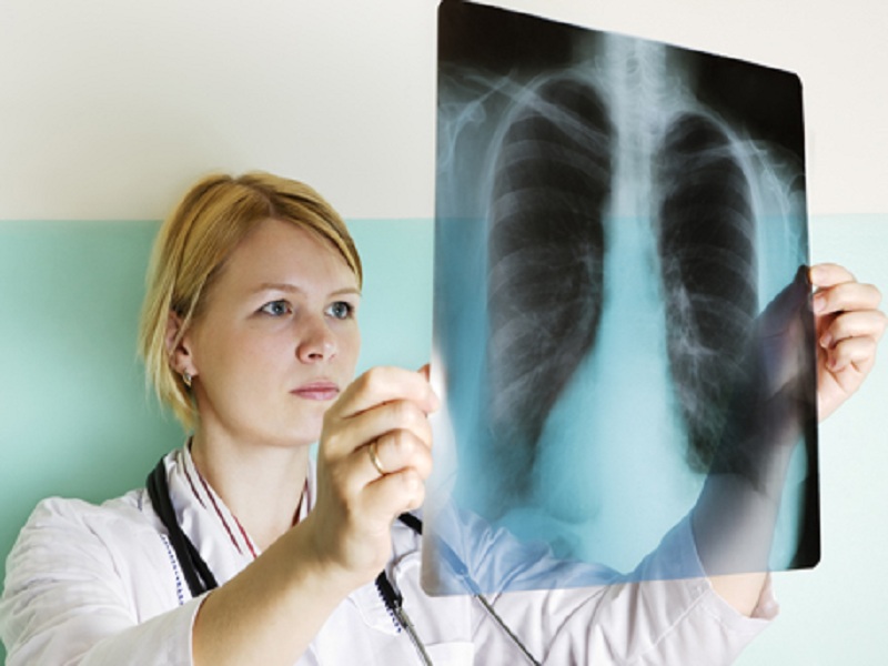 Il primo bilancio del RISP, Rete Italiana Screening Polmonare, il primo programma di screening del tumore al polmone, che coinvolge 18 centri italiani