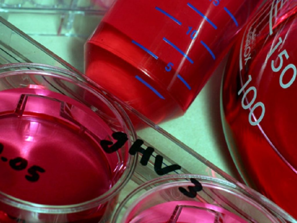 L'Fda ha approvato una estensione delle indicazioni di luspatercept per includere il trattamento dell'anemia in adulti con sindromi mielodisplastiche a basso rischio