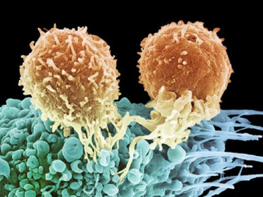 Leucemia linfoblastica acuta: primi segnali di attività per le CAR-T bispecifiche anti-CD19/CD22 secondo uno studio di fase 1 appena presentato