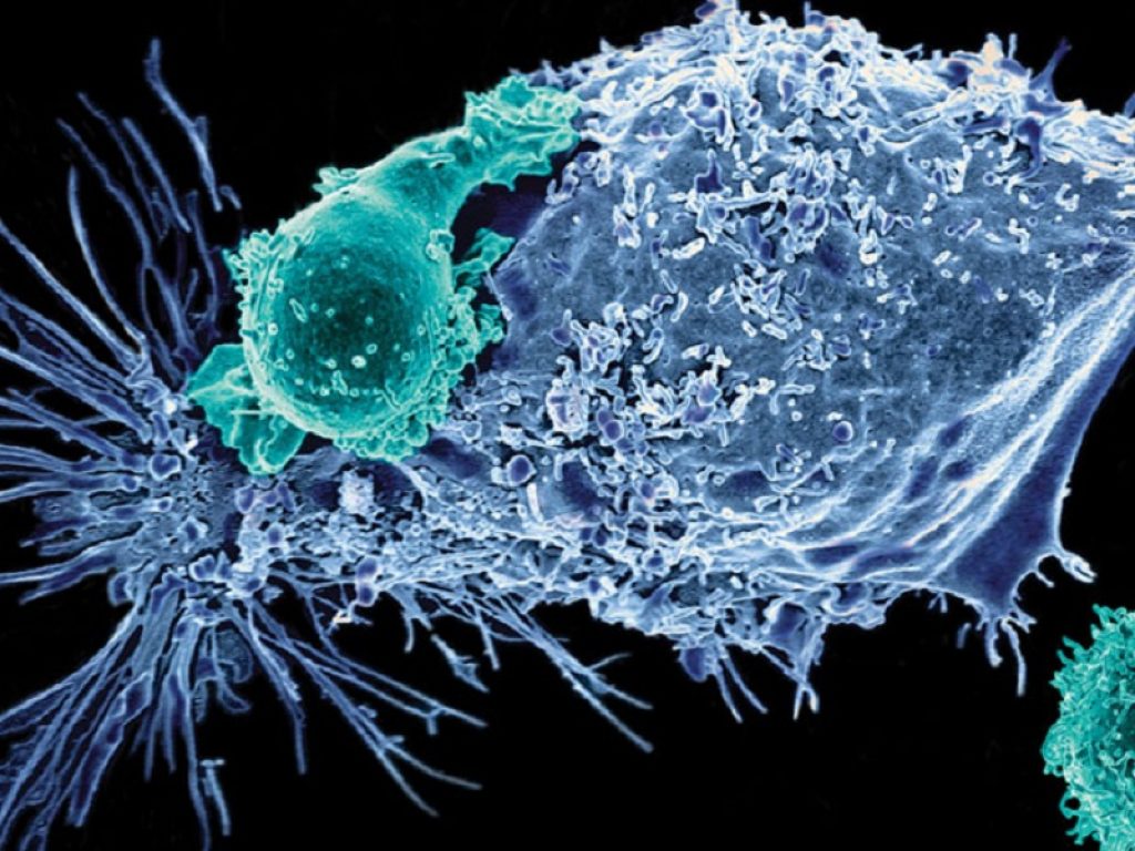 Linfoma diffuso a grandi cellule B: test per nuove cure