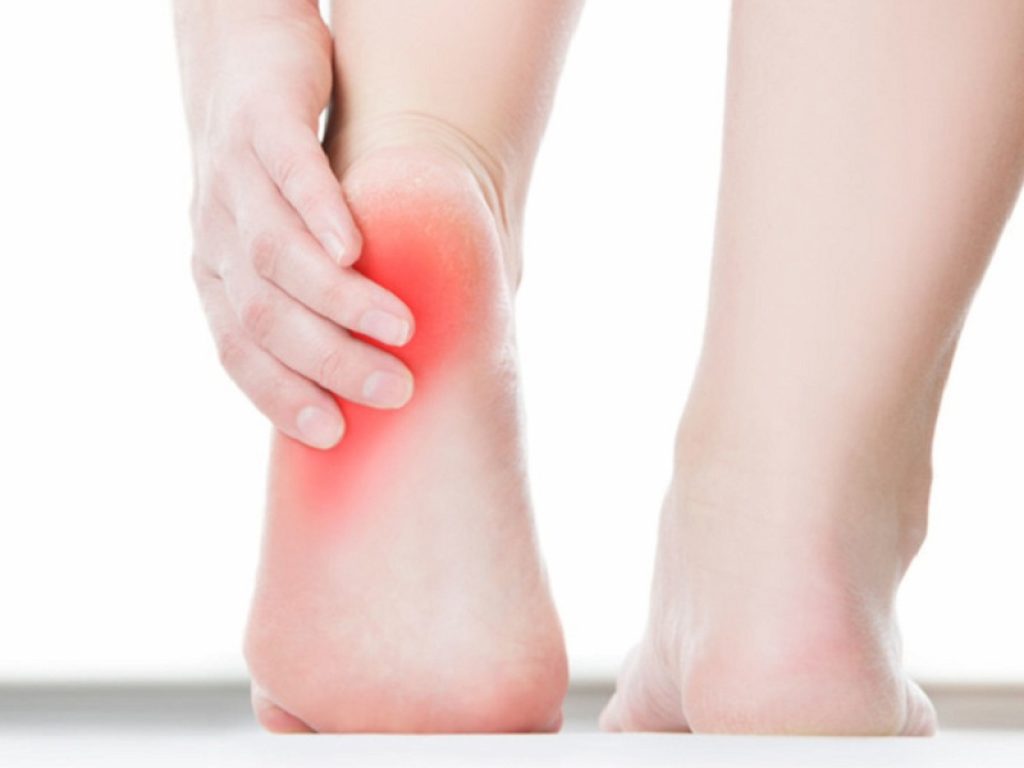 Fascite plantare: le strategie naturali per prevenirla