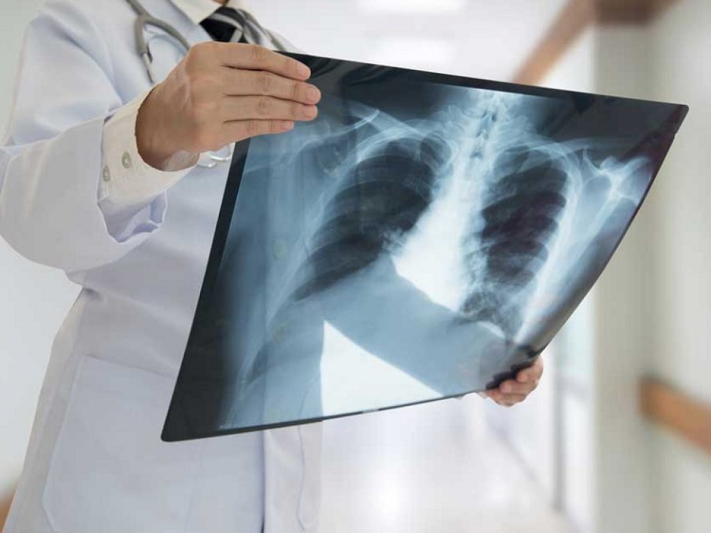 Una sottile pellicola di materiale organico che può trasformarsi in un potente rivelatore di raggi X è stata scoperta da ricercatori dell’Università di Bologna e dell’INFN