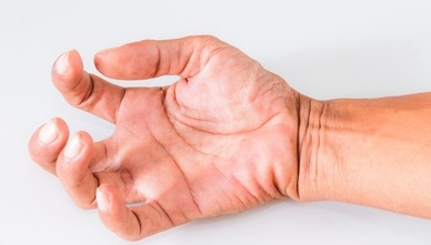 Spasticità o distonia cervicale: oltre l'80% dei pazienti trattati con tossina botulinica presenta una recidiva di sintomi debilitanti