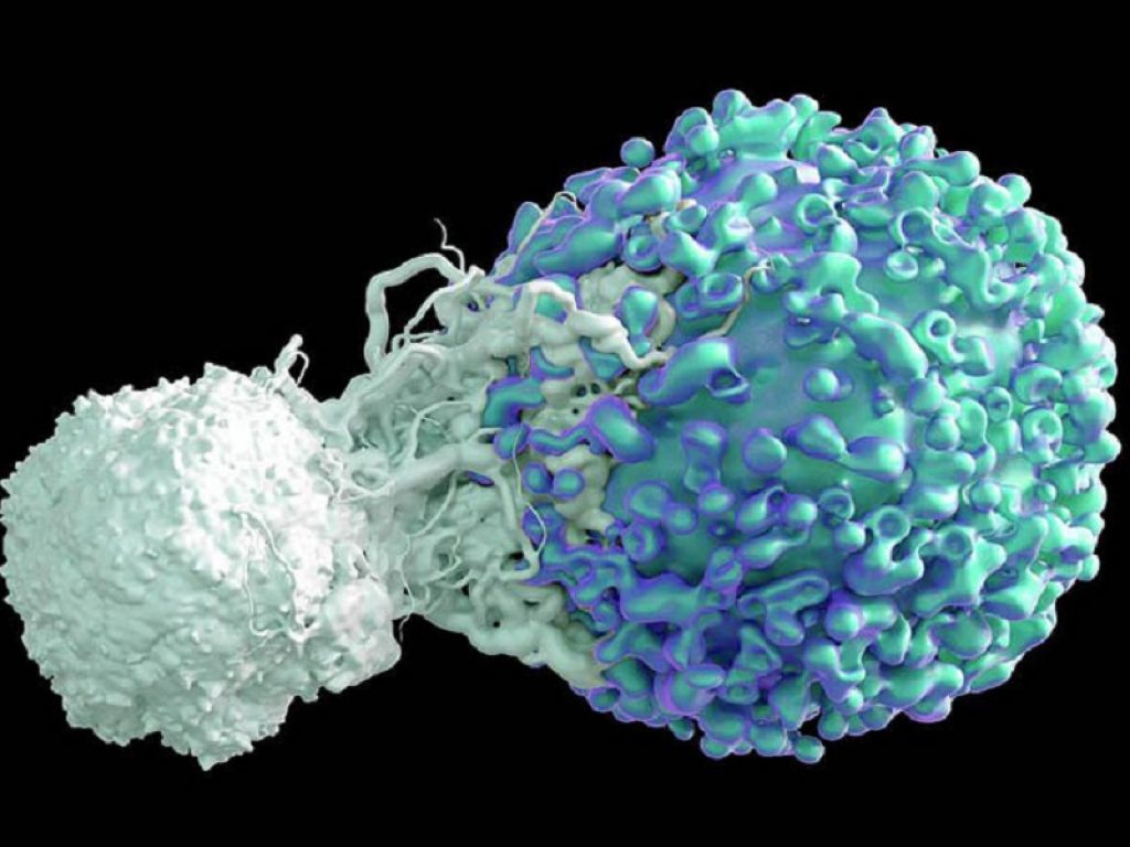 Linfoma non Hodgkin, un'analisi intermedia dello studio ZUMA-5 ha registrato risposte nel 90% dei pazienti trattati con le Car-T axicabtagene ciloleucel