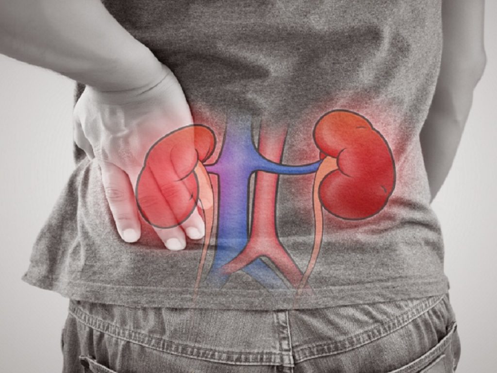 Nefrite lupica: la terapia di mantenimento con leflunomide ha la stessa efficacia di quella con azatioprina secondo un nuovo studio