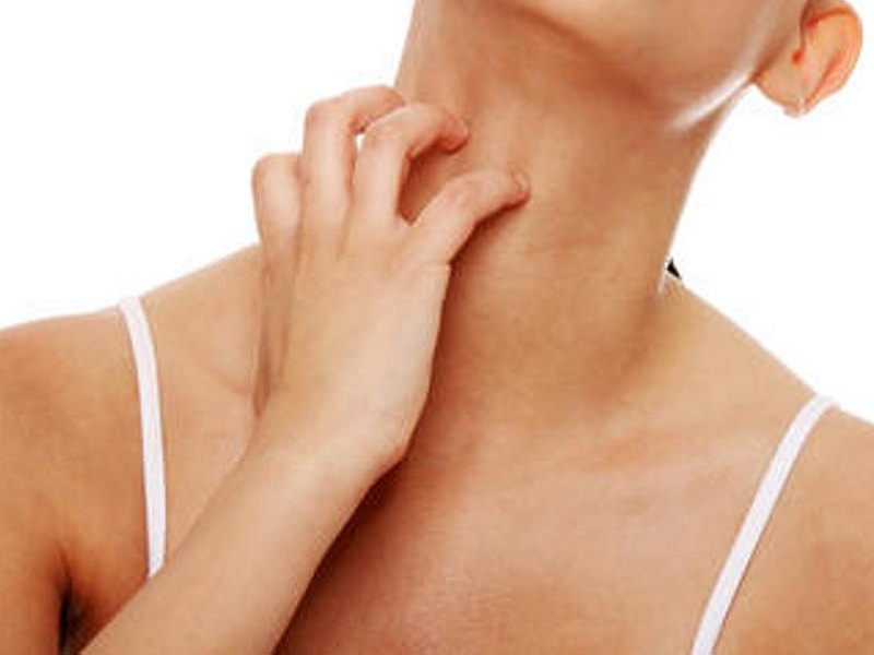 Dermatite atopica, il prurito migliora con nemolizumab