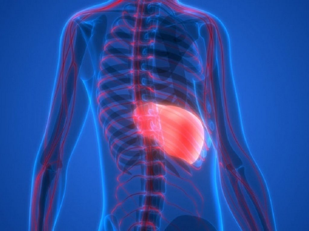 Acido obeticolico come trattamento per la steatoepatite non alcolica: la Fda statunitense ha rifiutato la richiesta di approvazione accelerata