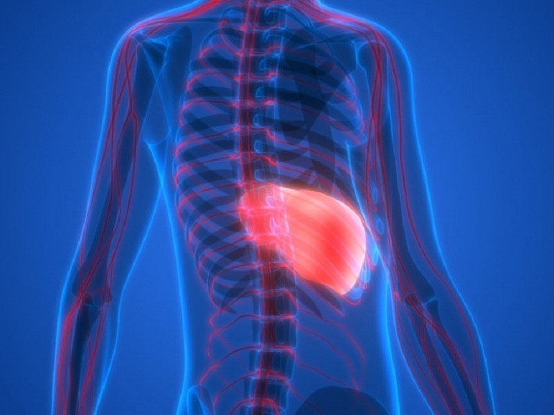 Acido obeticolico come trattamento per la steatoepatite non alcolica: la Fda statunitense ha rifiutato la richiesta di approvazione accelerata