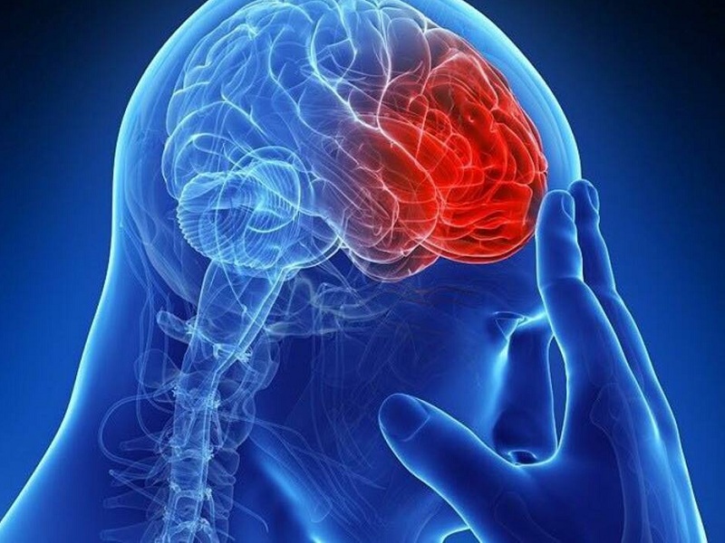 Benefici dall'abbassamento del colesterolo LDL con terapie a base di statine per i pazienti con una storia di ictus ischemico e aterosclerosi