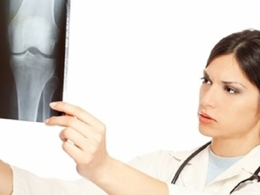Osteoporosi: abaloparatide sicuro per il cuore