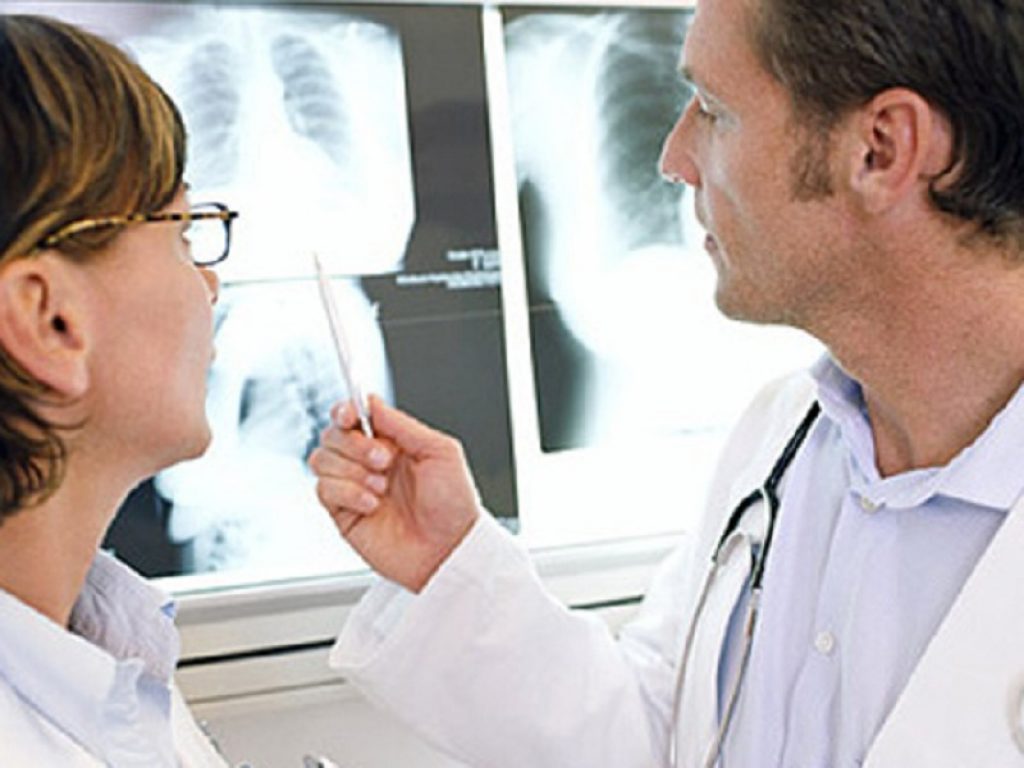 Nuovi dati sull'impiego di nintedanib in pazienti con fibrosi polmonare idiopatica da un'analisi post-hoc dello studio FIBRONET