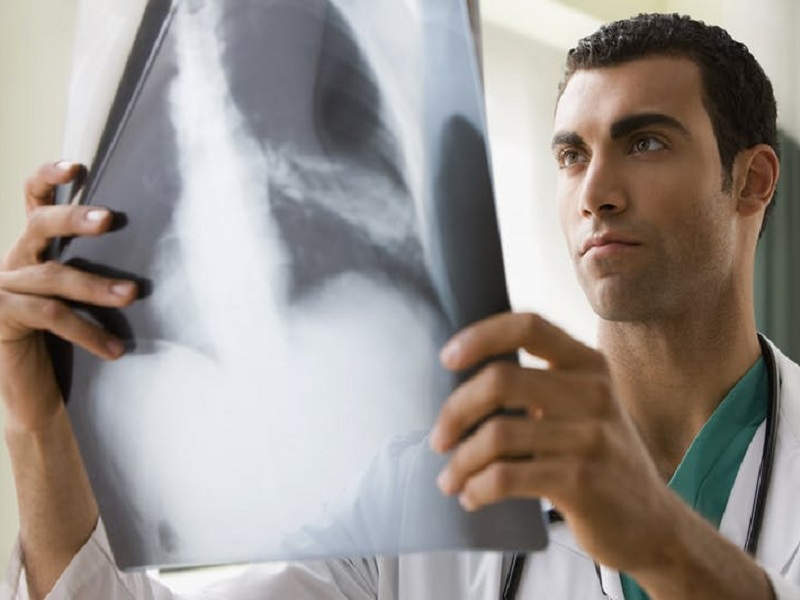 Gli steroidi inalatori per la Bpco potrebbero ridurre l'espressione del recettore di ingresso di SARS CoV2 (ACE2) delle cellule dell'apparato respiratorio