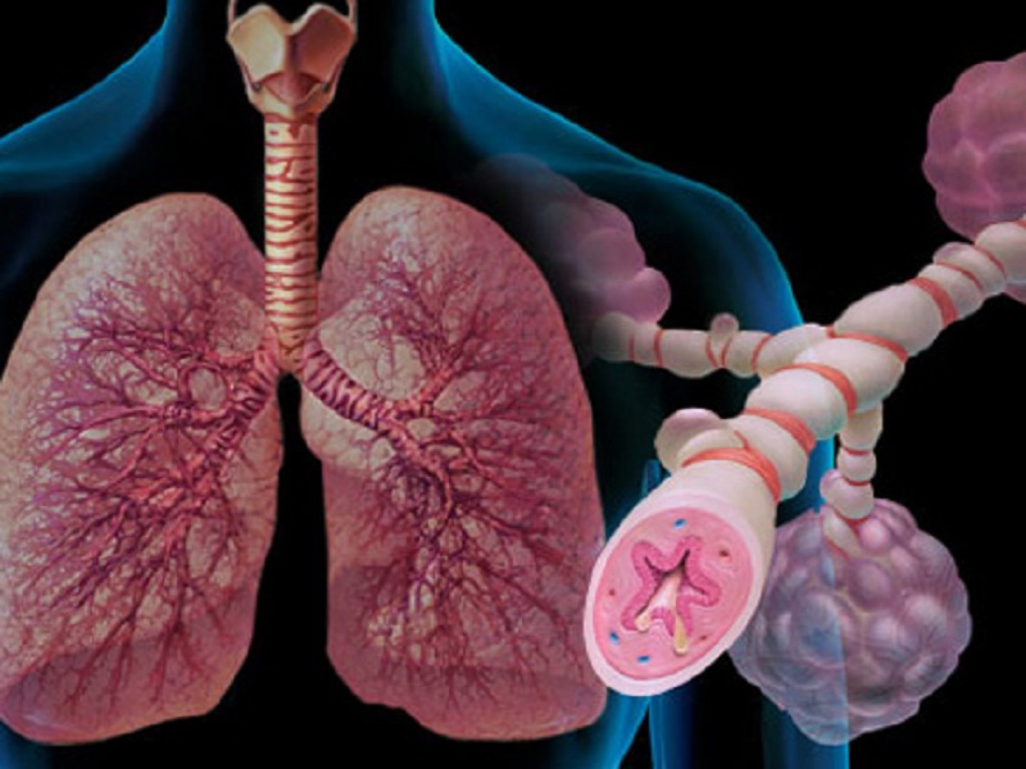 Bronchial asthma. Болезни органов дыхания бронхиальная астма. Бронхи больного бронхиальной астмой. Бронхиальная астма касаллиги. Острый бронхит и бронхиальная астма.
