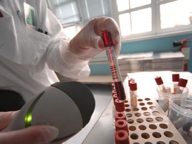 Epatite C in pazienti con carcinoma epatocellulare: secondo i risultati di una nuova analisi, raggiungere la risposta virologica sostenuta è fattibile