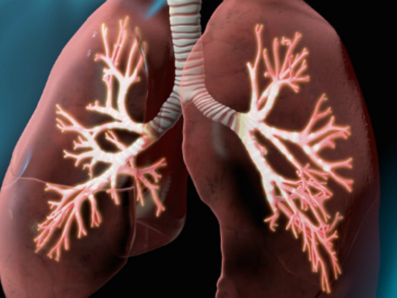 I pazienti con osteoporosi che assumono bisfosfonati azotati (N-BSF) presentano un rischio minore di sviluppare o morire di polmonite