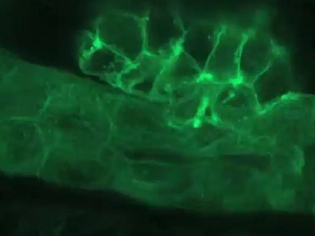 Scoperto il ruolo chiave della proteina Curvina