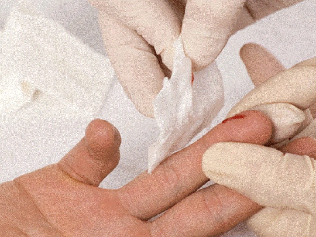 Diabete di tipo 2: la metformina può aumentare il rischio di anemia secondo dati di due trial clinici e di uno studio nel mondo reale