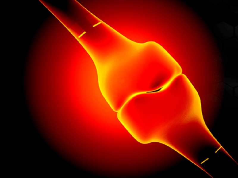 Artrite reumatoide: il trattamento con filgotinib da solo o in combinazione con MTX si associa con miglioramenti dei pazienti fino a 4 anni