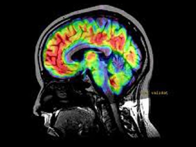 Inibitori del TNF rischiosi per il sistema nervoso centrale
