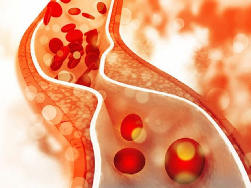 Elevati livelli di colesterolo HDL da soli potrebbero non essere cardioprotettivi per le donne in menopausa a causa dell'estradiolo