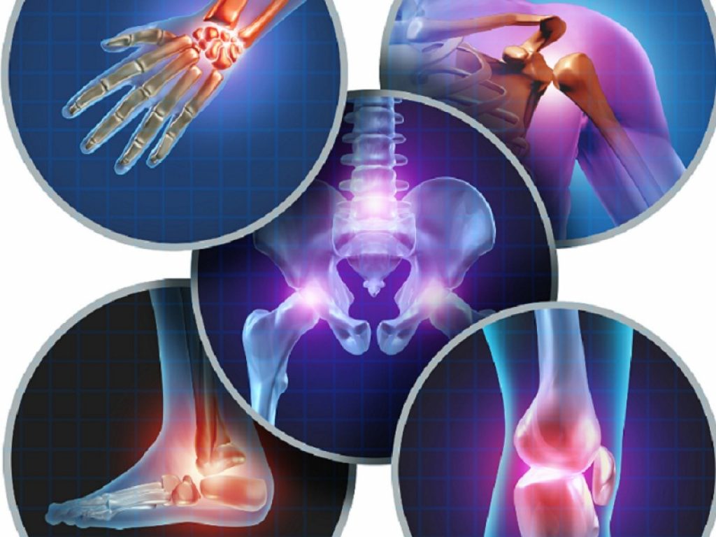 Dolore da osteoartrosi: scoperto come cambia