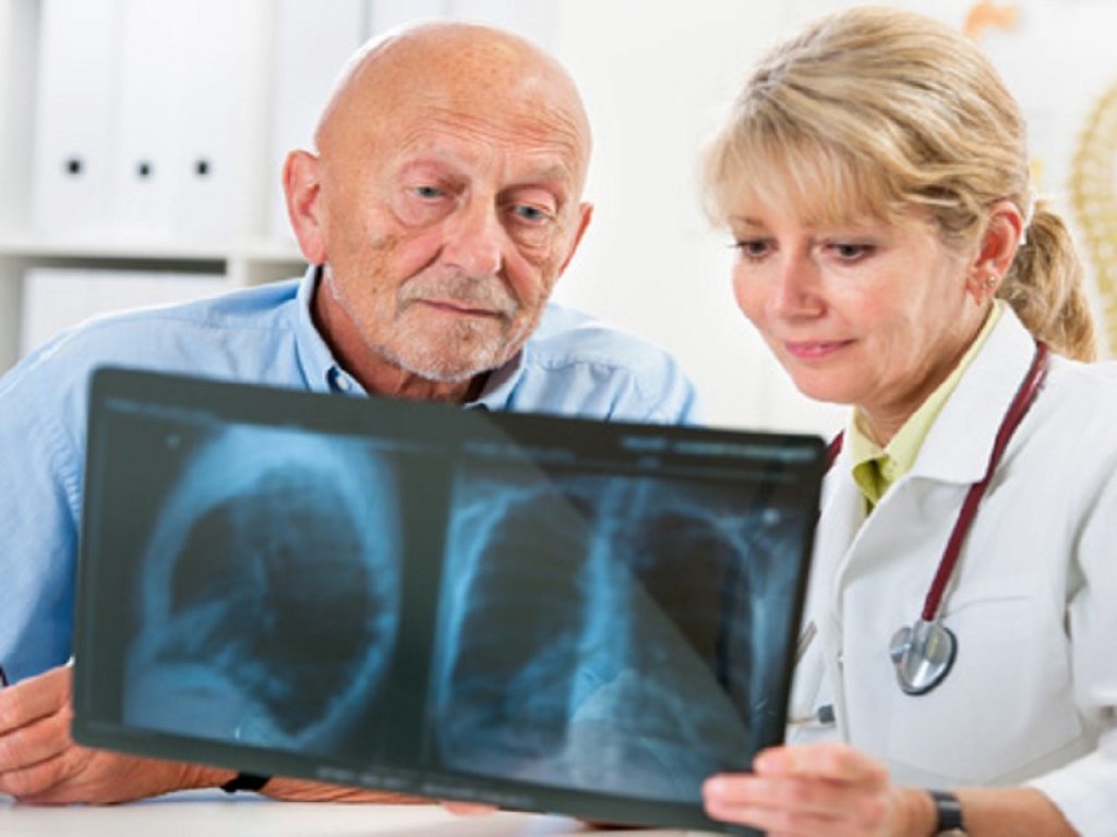 Interstiziopatie polmonari: per impostare un adeguato piano terapeutico c'è bisogno di una forte cooperazione tra diversi professionisti sanitari