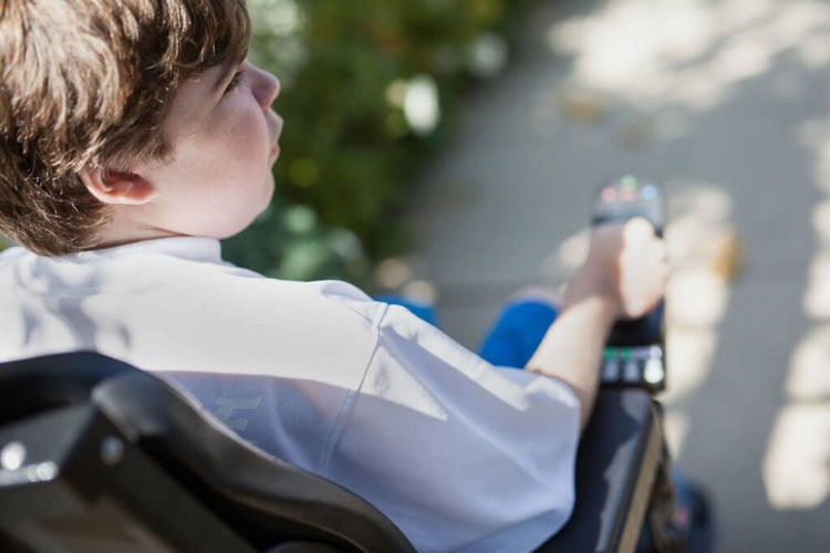 Givinostat, l'inibitore delle deacetilasi istoniche (HDAC), rallenta la progressione di malattia in bambini maschi affetti da distrofia muscolare di Duchenne