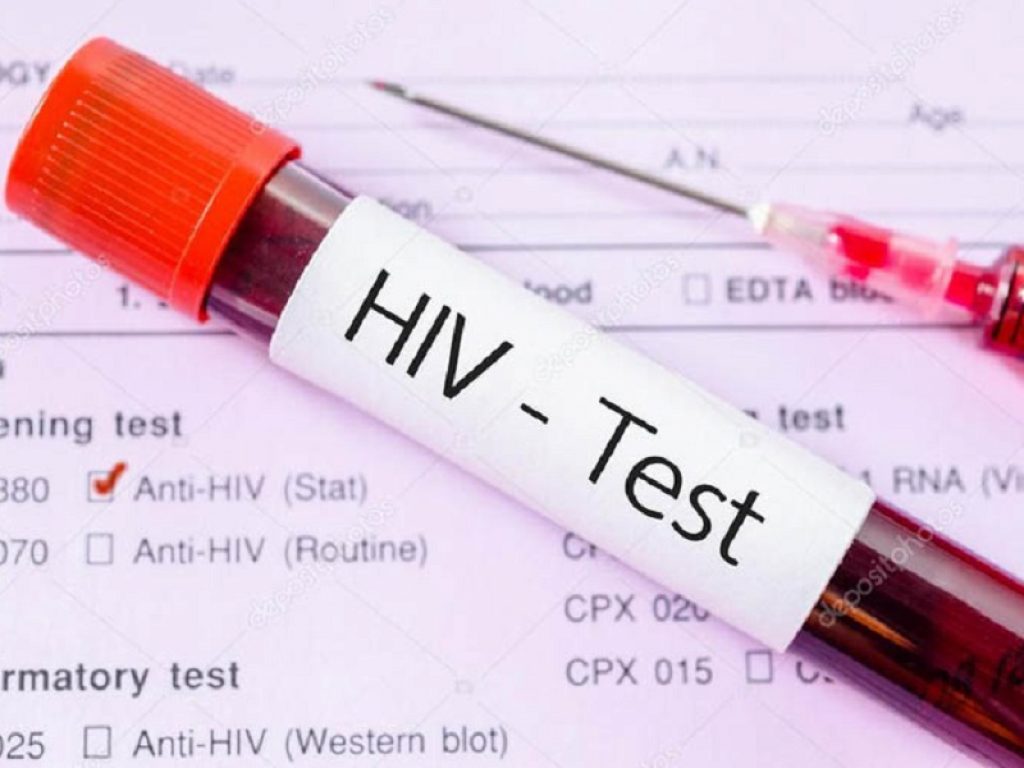 HIV: secondo i risultati di uno studio di fase III, con lenacapavir riduzione della carica virale in pazienti multiresistenti