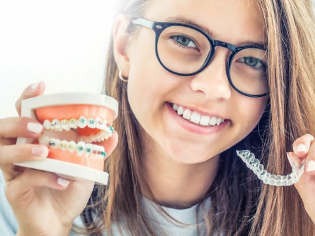 Apparecchio dentale: trasparente e tradizionale a confronto