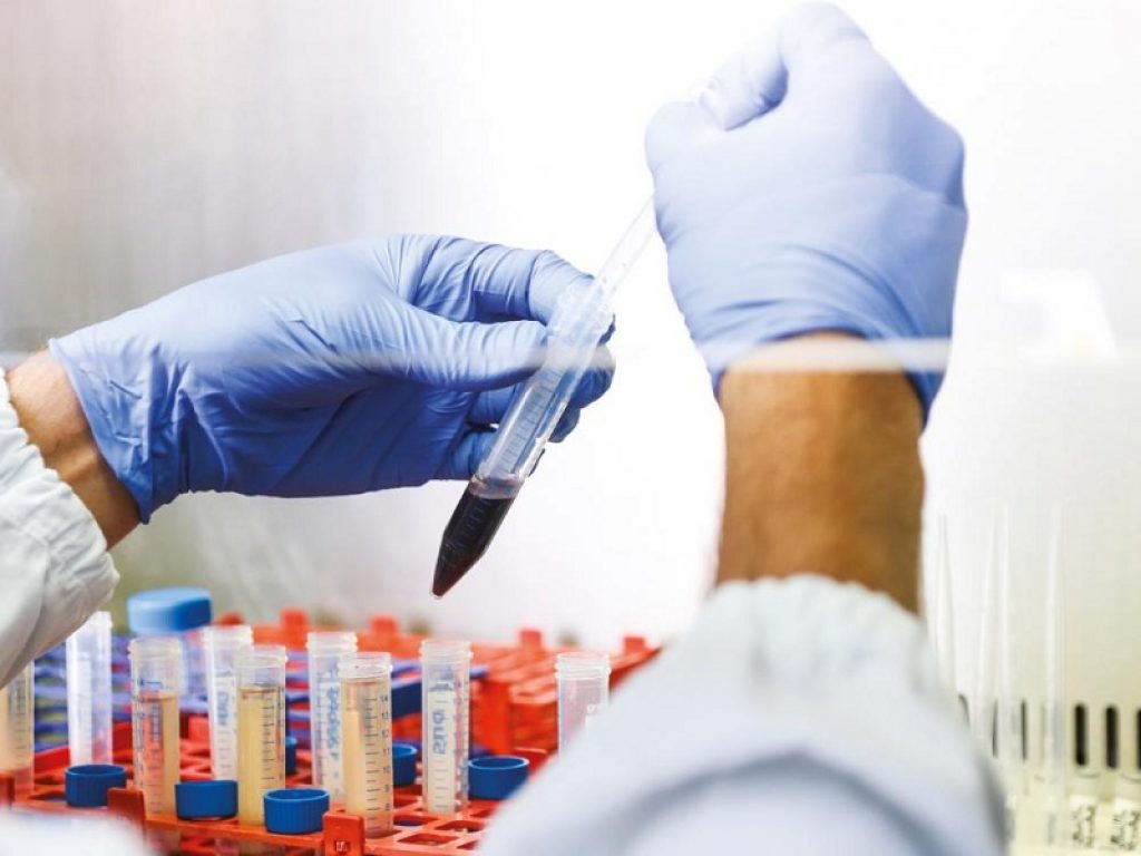 PEGASUS: biopsia liquida per il tumore del colon