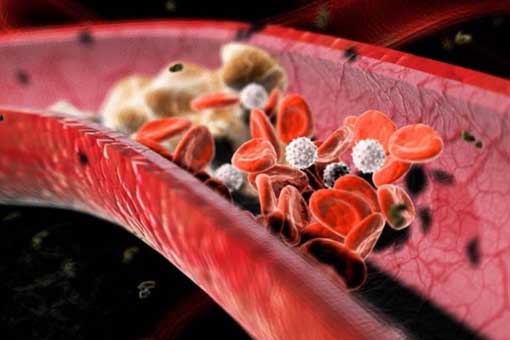 L'uso di rosuvastatina per il colesterolo potrebbe essere legato a un maggiore rischio di danno renale secondo nuovi dati retrospettivi real world