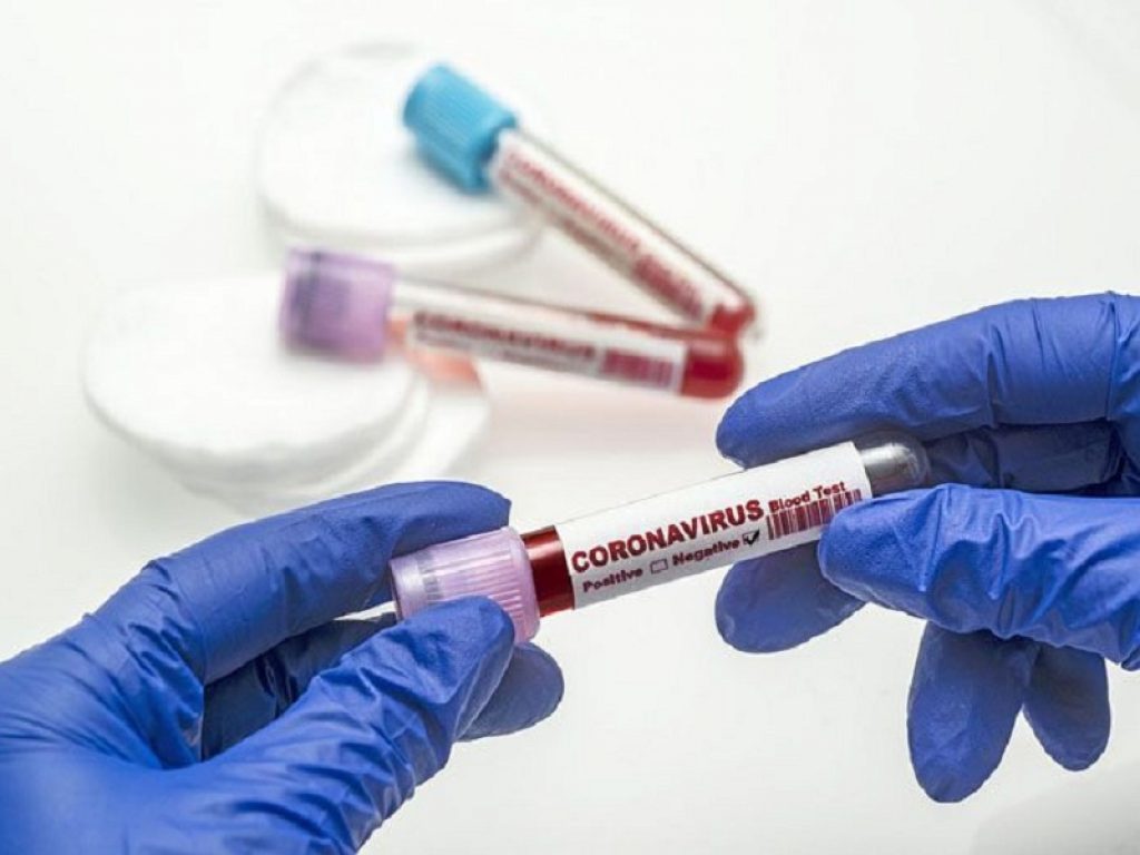 Covid, il bollettino di oggi: nelle ultime 24 ore si sono registrati 20.648 nuovi casi di positività su 176mila tamponi e 541 morti