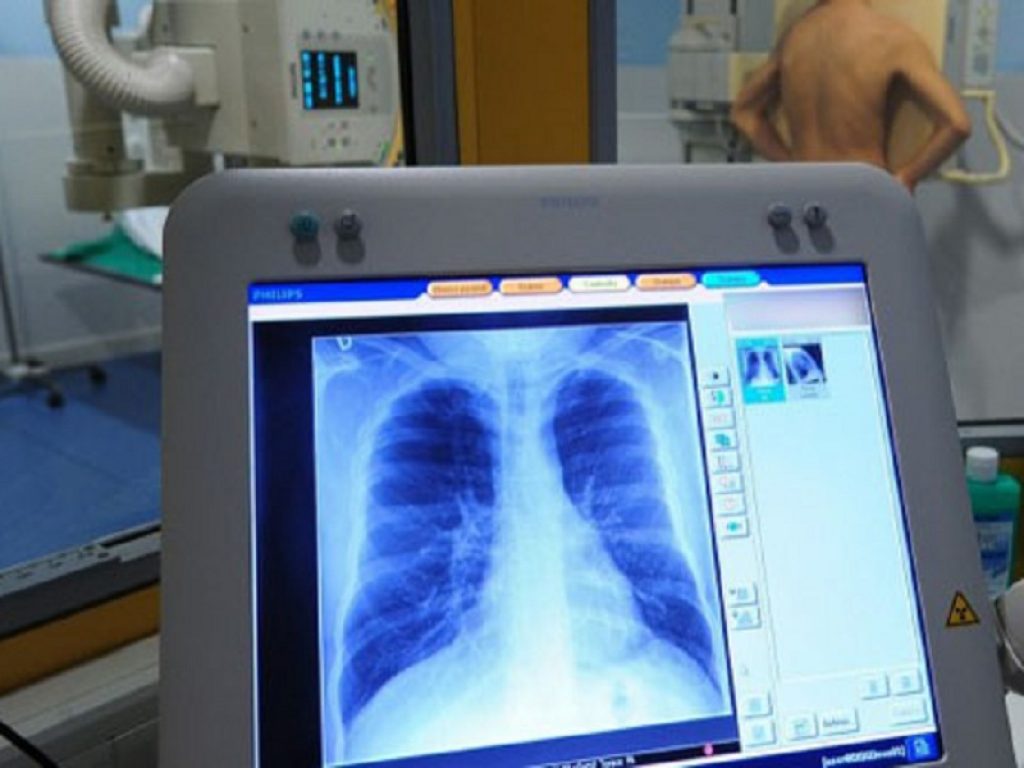 P. aeruginosa: terapia orale efficace come l'endovenosa