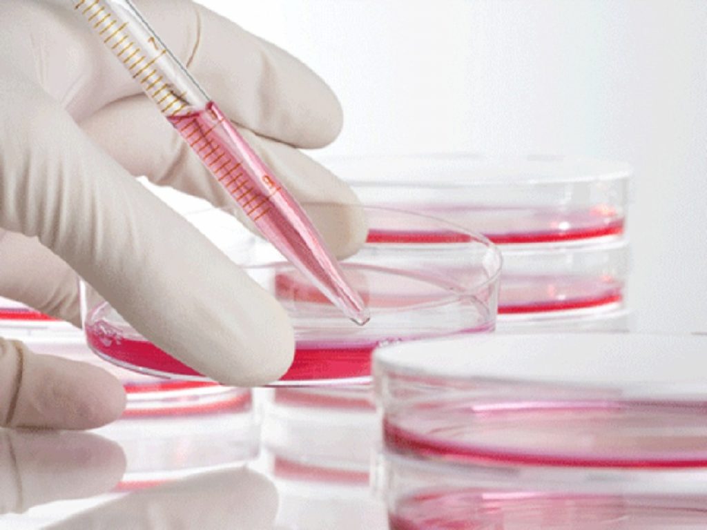 Linfoma non Hodgkin indolente recidivato:  copanlisib centra l'endpoint primario dello studio CHRONOS-3