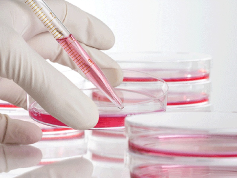 Linfoma non Hodgkin indolente recidivato:  copanlisib centra l'endpoint primario dello studio CHRONOS-3