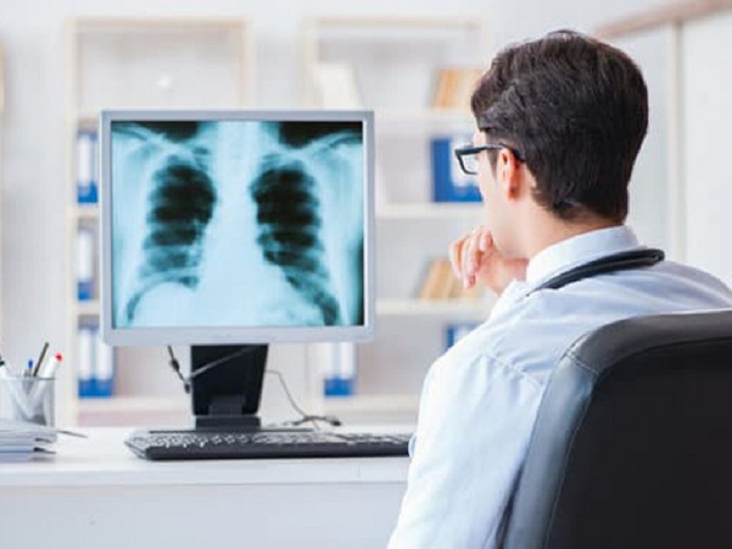 Ipertensione arteriosa polmonare: riociguat utile alternativa alla terapia con inibitori di fosfodiesterasi 5 secondo un nuovo studio