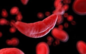 Presentati nuovi dati che confermano l'efficacia di exa-cel, precedentemente noto come CTX001, nei pazienti affetti da beta-talassemia o da anemia a cellule falciformi