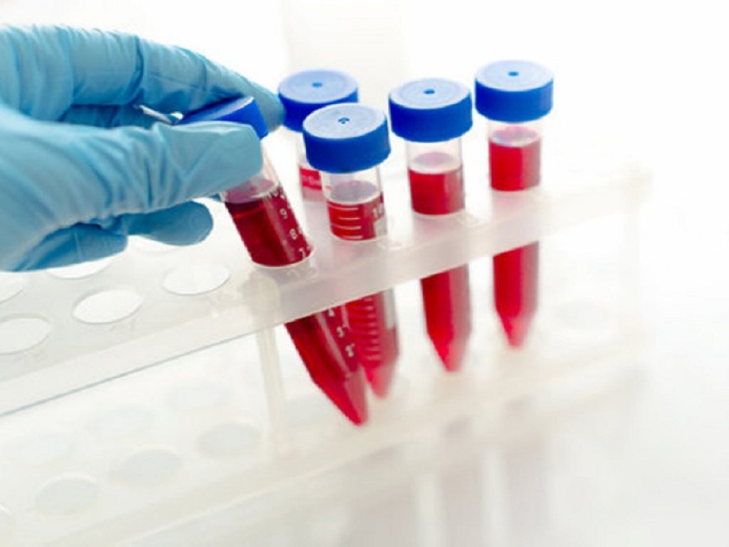 Inibitori delle proteine simili all'angiopoietina sono la nuova frontiera della ricerca per il controllo dell'ipertrigliceridemia