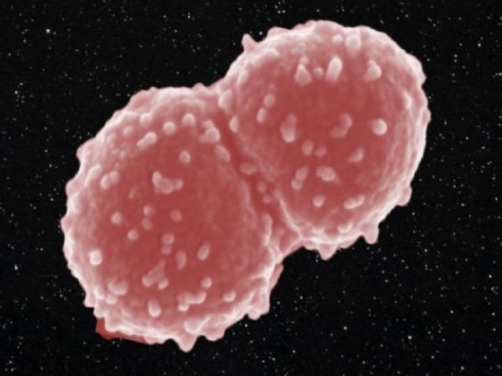 Deinococcus: il batterio è resistito un anno nello spazio