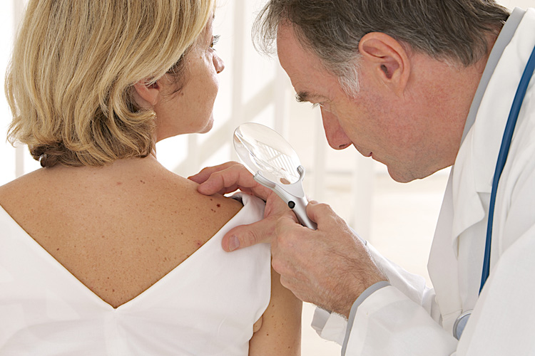 Melanoma resecato avanzato e metastasi cerebrali: nell'ultimo anno la Fondazione NIBIT ha sviluppato 6 studi clinici, tutti coordinati dal CIO dell'Azienda ospedaliero-universitaria Senese