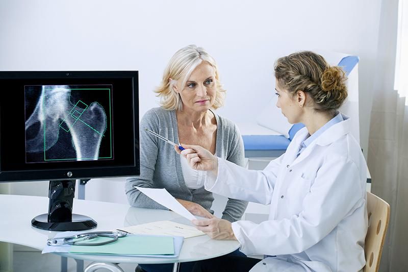 Osteoporosi: i benefici dell'uso dei bisfosfonati superano l'aumento del rischio di fratture atipiche al femore nelle donne in età avanzata