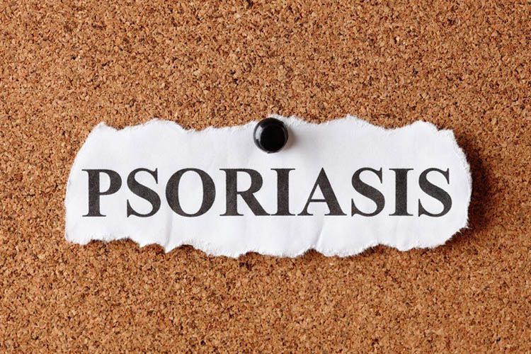 psoriasi genitale