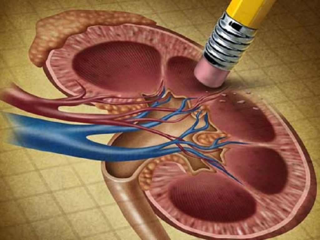 Tumore del rene avanzato: la combinazione di pembrolizumab e lenvatinib si è dimostrata efficace a prescindere dallo stato dei biomarcatori
