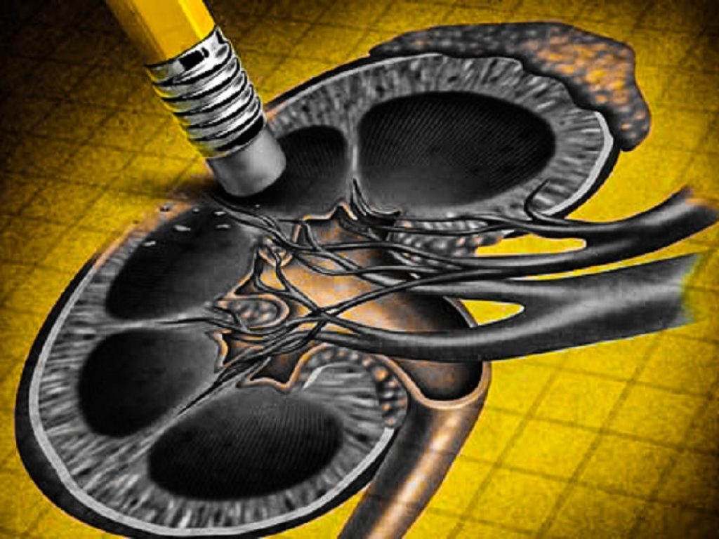 Malattia renale diabetica: il trattamento con finerenone determina una significativa riduzione degli eventi cardiovascolari secondo un nuovo studio