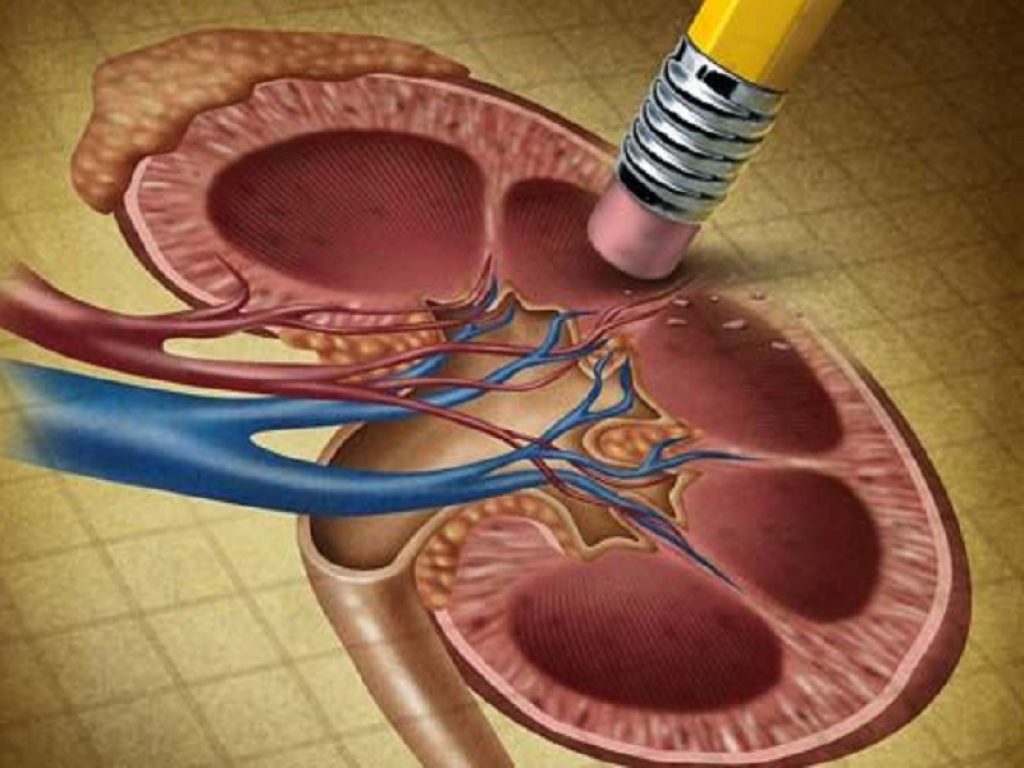 Ertugliflozin preserva la funzione renale nei pazienti con diabete di tipo 2 e malattie cardiovascolari secondo un nuovo studio