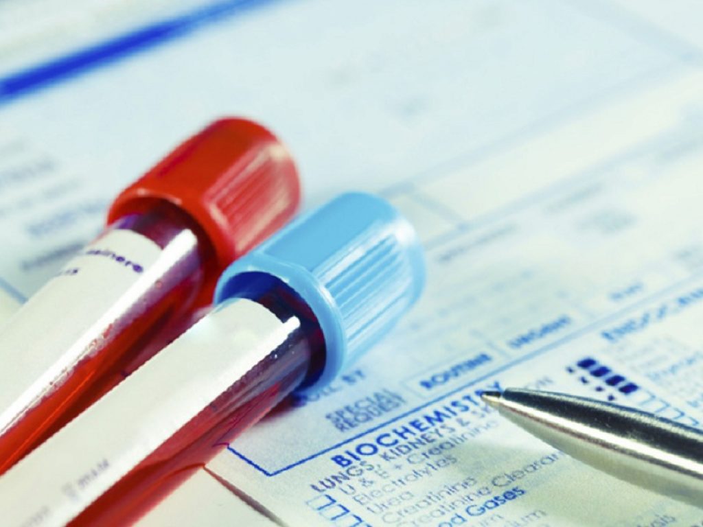 I pazienti con gruppo sanguigno 0 e Rh-positivo potrebbero avere una maggiore protezione contro il COVID-19: i dati dello studio presentato da IVI