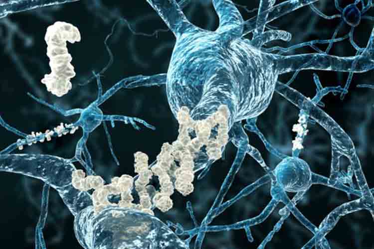 Alzheimer: l'integrazione di una molecole di microRNA può ristabilire la neurogenesi nell'ippocampo, alleviando i deficit di memoria