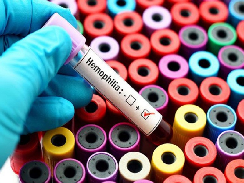 Roctavian concizumab emofilia a grave