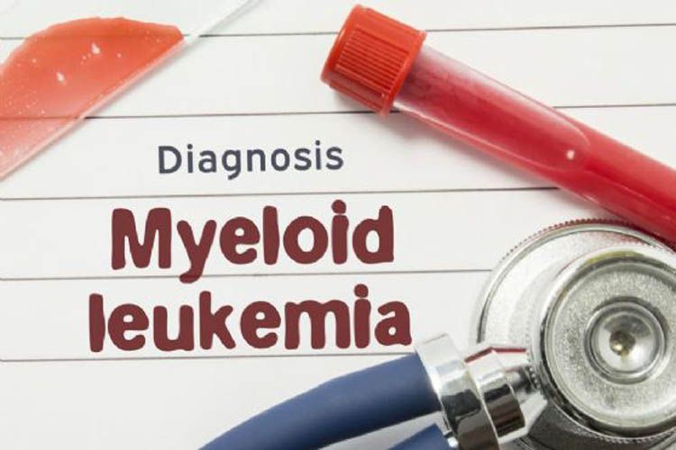 Leucemia mieloide acuta: l'Agenzia Italiana del Farmaco (AIFA) ha approvato la rimborsabilità di azacitidina orale come terapia di mantenimento